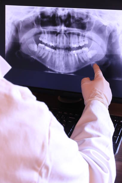 Best Emergency Gum Treatment in Arden On The Severn, MD