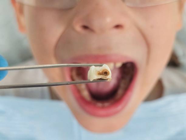 Best Emergency Treatment for Dental Infections or Abscesses in Arden On The Severn, MD